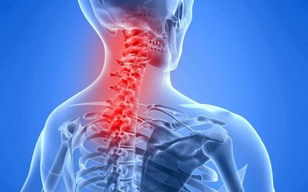 آیا آرتروز گردن درمان قطعی دارد؟