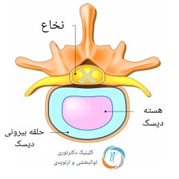 InShot_20240425_214057766 دیسک