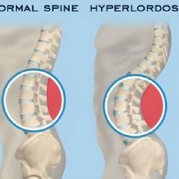 گودی کمر دکتر نوری گودی کمر